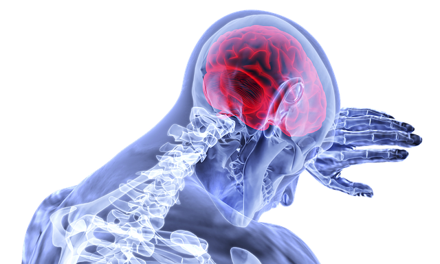 Alzheimer's disease